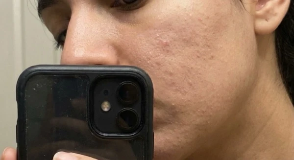 Rough uneven skin texture