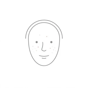 Mild acne illustration