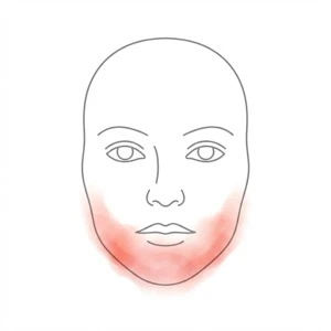 Jawline and chin zone